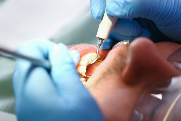Best Emergency Pediatric Dental Care in West Branch, IA