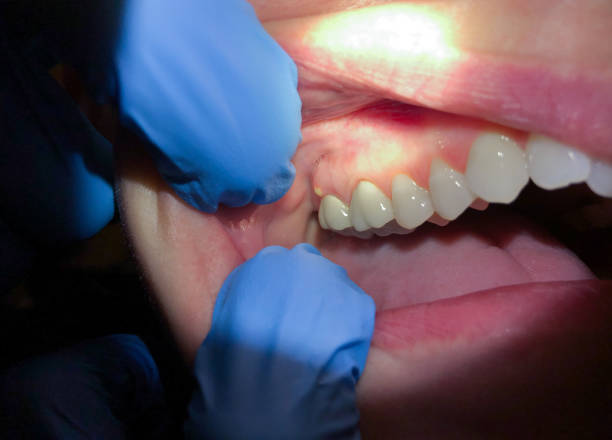 Best Emergency Treatment for Jaw Pain or Injury in West Branch, IA